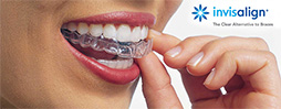 invisalign-final-smallest